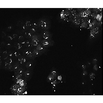AKT3 Antibody Combo Pack, 1Pack, Liquid and Lyophilized