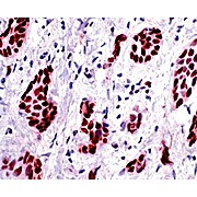 Anti-PROGESTERONE RECEPTOR (RABBIT) Monoclonal Antibody, 100µL, Liquid (sterile filtered)