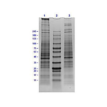 U-138 MG Whole Cell Lysate, 500µg, Liquid (sterile filtered)