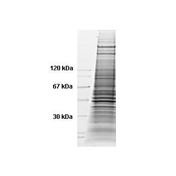 HeLa WCL Etoposide 500µg