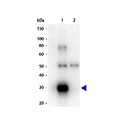 F(ab')2 Anti-HUMAN ? (lambda chain) (GOAT) Antibody Peroxidase Conjugated, 1mg, Lyophilized