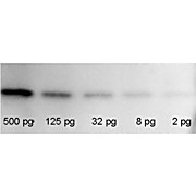 RFP Western Blot Kit: for RFP Chemiluminescent Western Blotting, 1Each