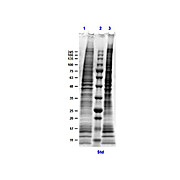 MDA-MB-231 Whole Cell Lysate, 500µg, Liquid (sterile filtered)