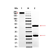 GOAT Gamma Globulin Fraction, 1g, Lyophilized