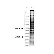 Hep2 Whole Cell Lysate 500µg