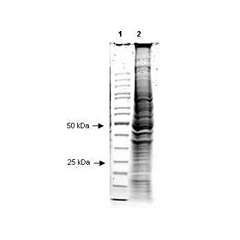 Hep2 Whole Cell Lysate 500µg