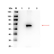 AKT2 Antibody Combo Pack, 1Pack,  Liquid and Lyophilized