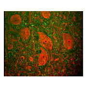 Anti-Ubiquitin Hydrolase (UCHL1) (Mouse) Monoclonal Antibody, 100µL, Liquid