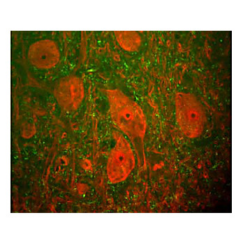 Anti-Ubiquitin Hydrolase (UCHL1) (Mouse) Monoclonal Antibody, 100µL, Liquid