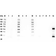 F(ab')2 Anti-MOUSE IgG (H&L) (GOAT) Antibody Peroxidase Conjugated Min X Bv Hs Hu Rb Rt & Sh Serum Proteins, 500µg, Lyophilized