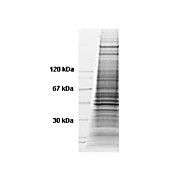 HeLa WCL Doxorubicin 500µg