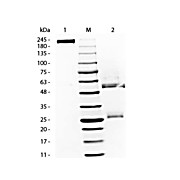 RAT Gamma Globulin Fraction, 50mg, Lyophilized