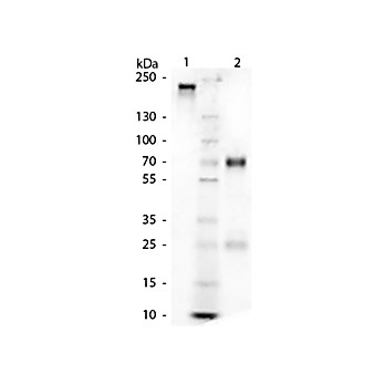 CHICKEN Gamma Globulin Fraction, 100mg, Lyophilized