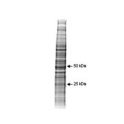 A431 Whole Cell Lysate 500µg
