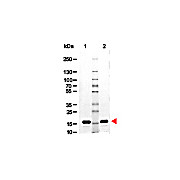 AVIDIN, 10mg, Lyophilized