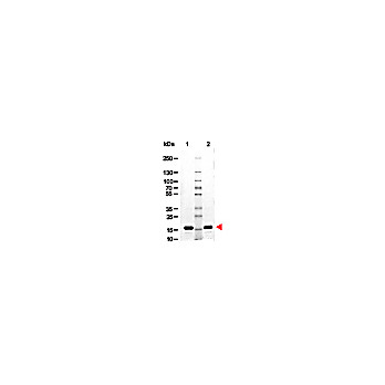 AVIDIN, 10mg, Lyophilized
