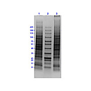 LNCaP Whole Cell Lysate, 500µg, Liquid (sterile filtered)