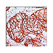 Anti-c-erbB2 (RABBIT) Monoclonal Antibody, 100µL, Liquid (sterile filtered)