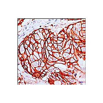 Anti-c-erbB2 (RABBIT) Monoclonal Antibody, 100µL, Liquid (sterile filtered)