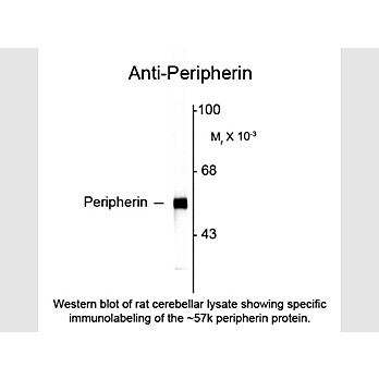 Anti-Peripherin (Mouse) Antibody, 100µL, Liquid