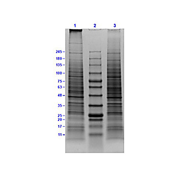 Daudi Whole Cell Lysate, 500µg, Liquid (sterile filtered)