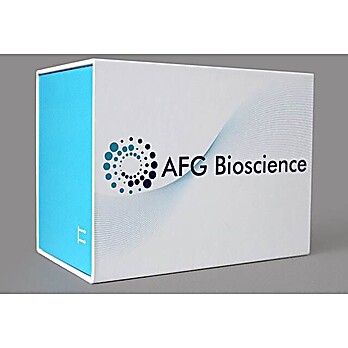Human Fatty acid-binding protein 1 (FABP1) ELISA Kit