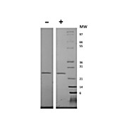 Human Epstein-Barr Virus Induced Gene 3 Recombinant Protein
