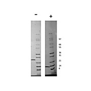 Human Artemin Recombinant Protein