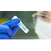 NATtrol Human Herpes Virus (HHV)