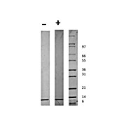Human Beta-cell Attracting Chemokine 1 (CXCL13) Recombinant Protein