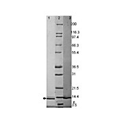 GM-CSF Human Recombinant Protein