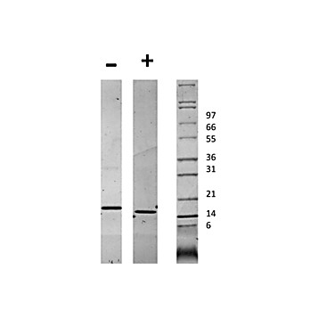 Human CD40 Ligand Recombinant Protein