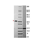 VEGF-165 Human Recombinant Protein