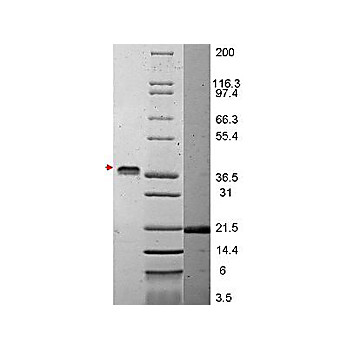 VEGF-165 Human Recombinant Protein