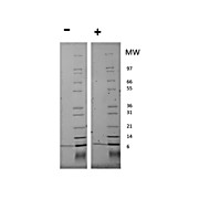 Human Neuregulin 1-beta Recombinant Protein