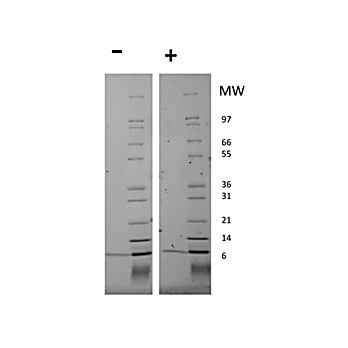 Human Neuregulin 1-beta Recombinant Protein