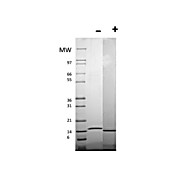 Human CD40 Ligand Recombinant Protein (Animal Free)