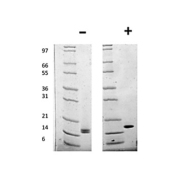 Human Fibroblast Growth Factor acidic Recombinant Protein