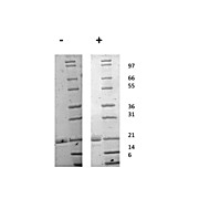 Mouse Interleukin-11 Recombinant Protein