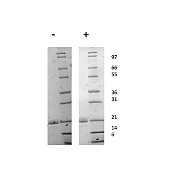 Mouse Interleukin-11 Recombinant Protein