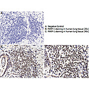 Anti-PARP1 (N-term ZF1) (RABBIT) Antibody