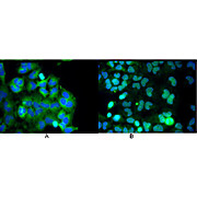 Anti-NFKB p65 (Rel A) (MOUSE) Monoclonal Antibody
