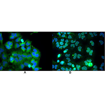 Anti-NFKB p65 (Rel A) (MOUSE) Monoclonal Antibody