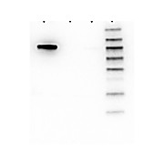 AKT1 Antibody [5E5.F5.D7]