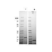 Human Resistin Dimer Recombinant Protein