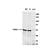 Anti-PYRUVATE KINASE (Rabbit Muscle) (GOAT) Antibody