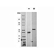Human Follistatin Recombinant Protein