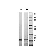 Human Insulin-like Growth Factor II Recombinant Protein