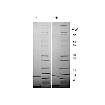 Mouse Interleukin-13 Recombinant Protein