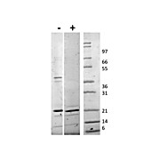 Human TRAIL Recombinant Protein